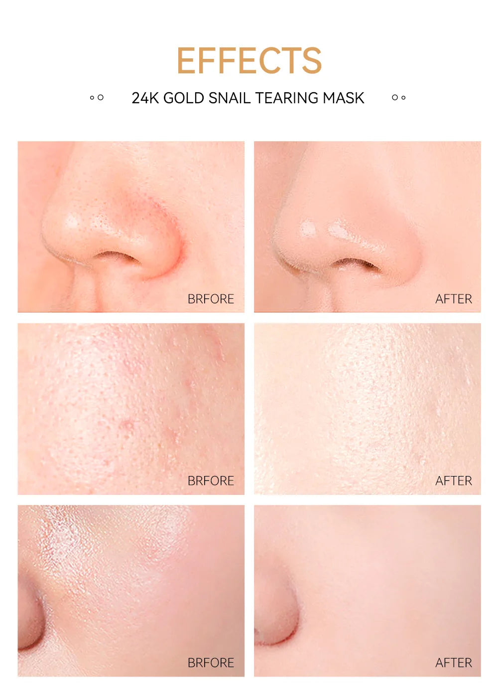 24K Gold Sakura Peel-Off Mask – Blackhead Removal & Brightening