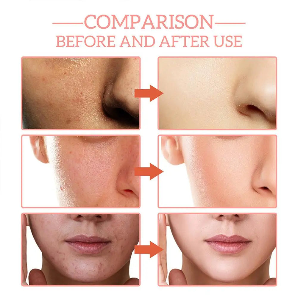 5-in-1 Firming Face Serum – Vitamin C & Hyaluronic Acid