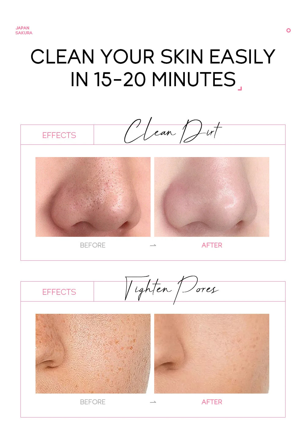 24K Gold Sakura Peel-Off Mask – Blackhead Removal & Brightening
