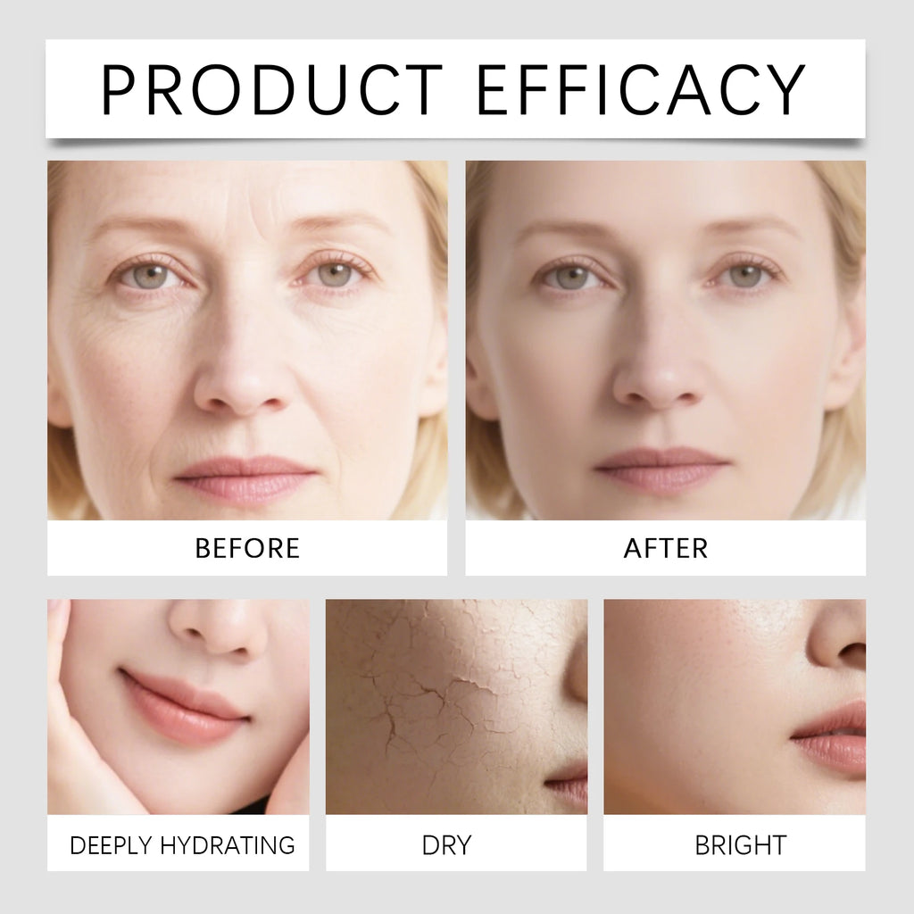 Niacinamide Microneedle Serum Kit – Face Roller & Serum Set
