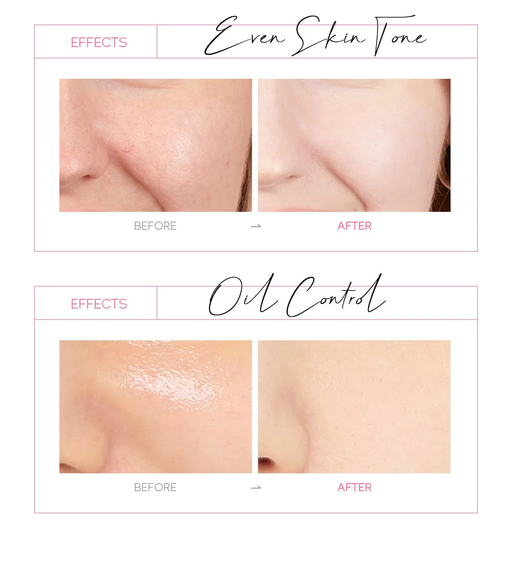 24K Gold Sakura Peel-Off Mask – Blackhead Removal & Brightening